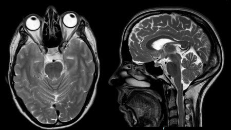 Mri-Onderzoek - Alrijne Ziekenhuis